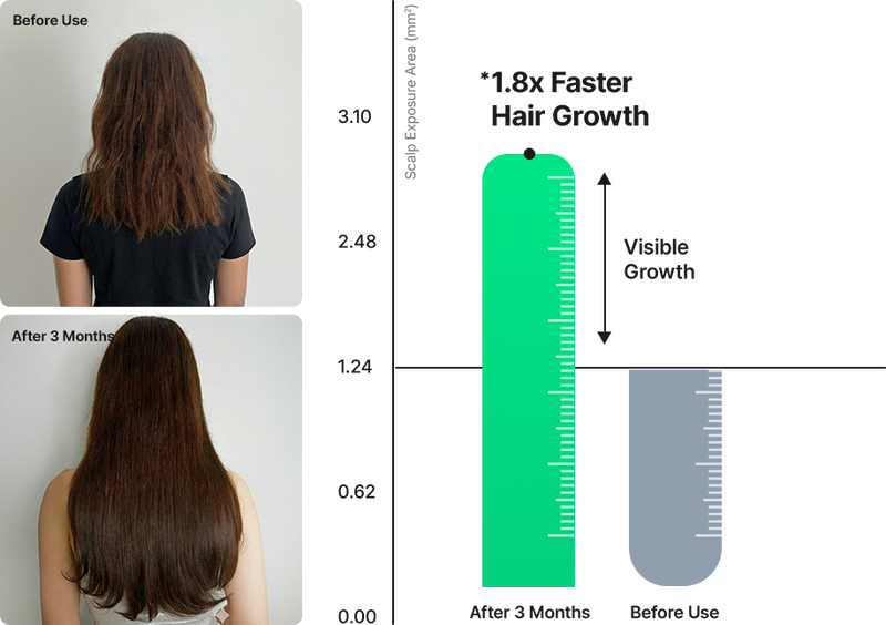 Clinical Scalp Care,
Powerful Support for 
Hair Growth