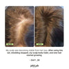 Exosome, NAD+ & Triple PDRN Hair & Scalp Therapy Set