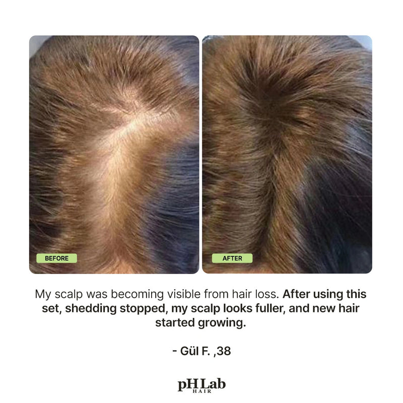 Exosome, NAD+ & Triple PDRN Hair & Scalp Therapy Set