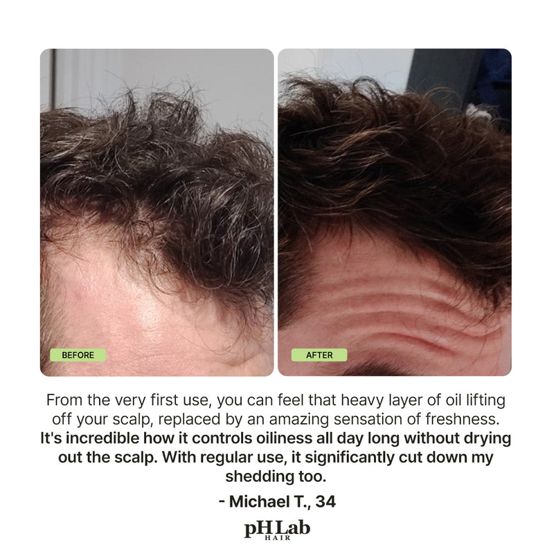 Exosome, NAD+ & Triple PDRN  Hair & Scalp Care Shampoo Men - 9
