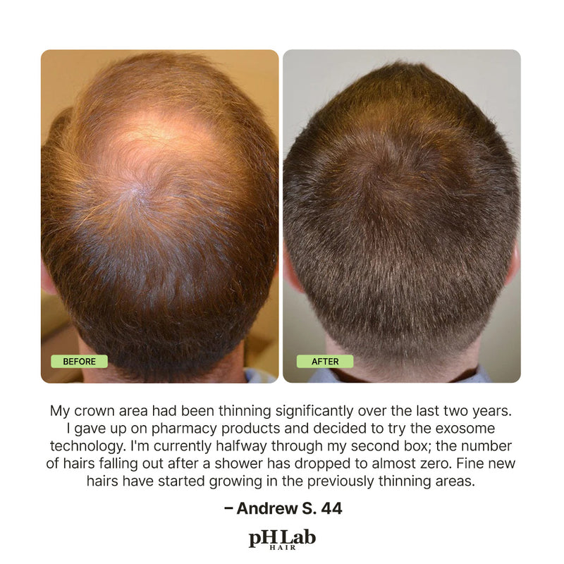 Exosome, NAD+ & Triple PDRN Scalp Shot Men - 11