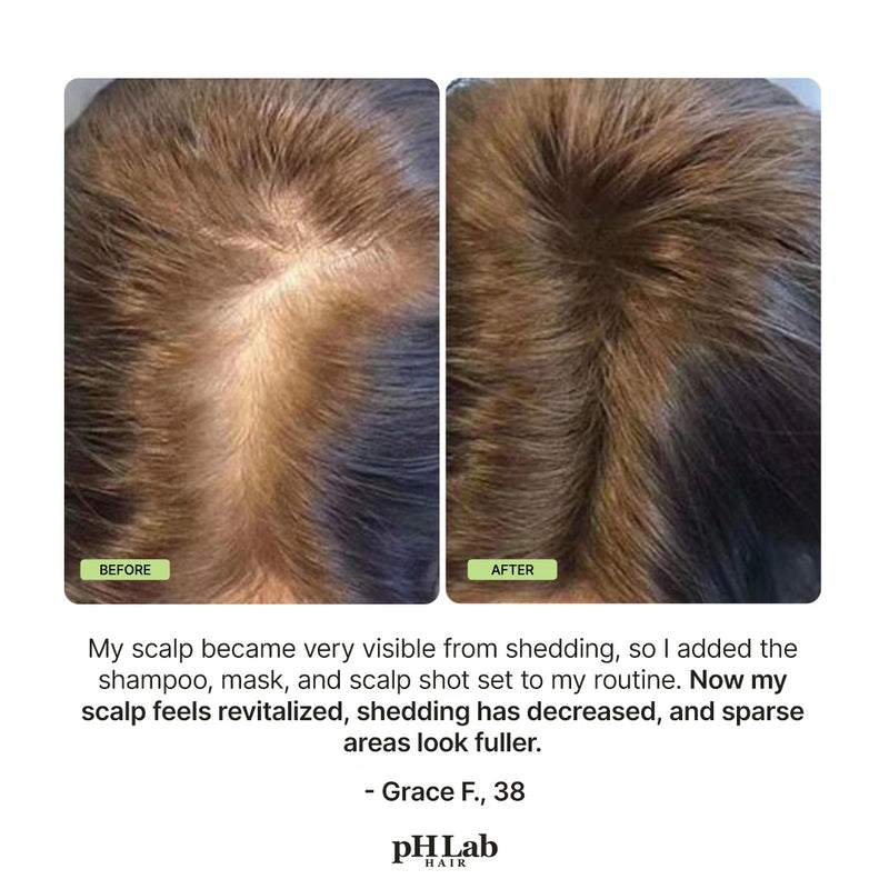 Exosome, NAD+ & Triple PDRN Hair & Scalp Therapy Set - 9