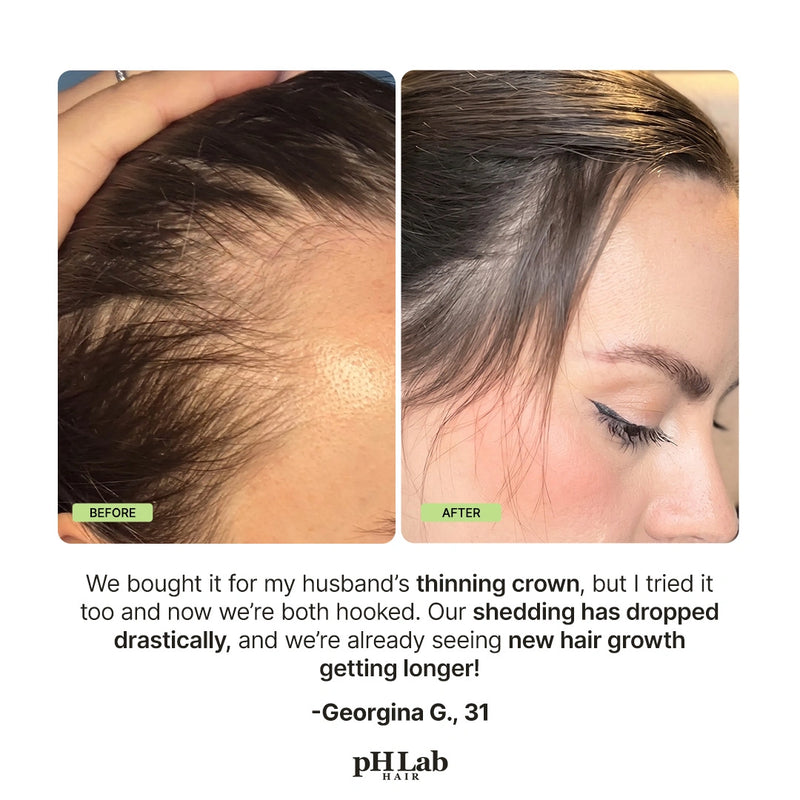 Exosome, NAD+ & Triple PDRN Scalp Shot - 10