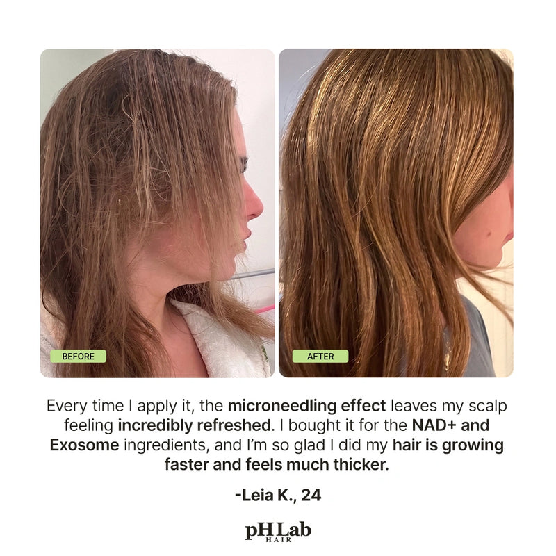 Exosome, NAD+ & Triple PDRN Scalp Shot - 11