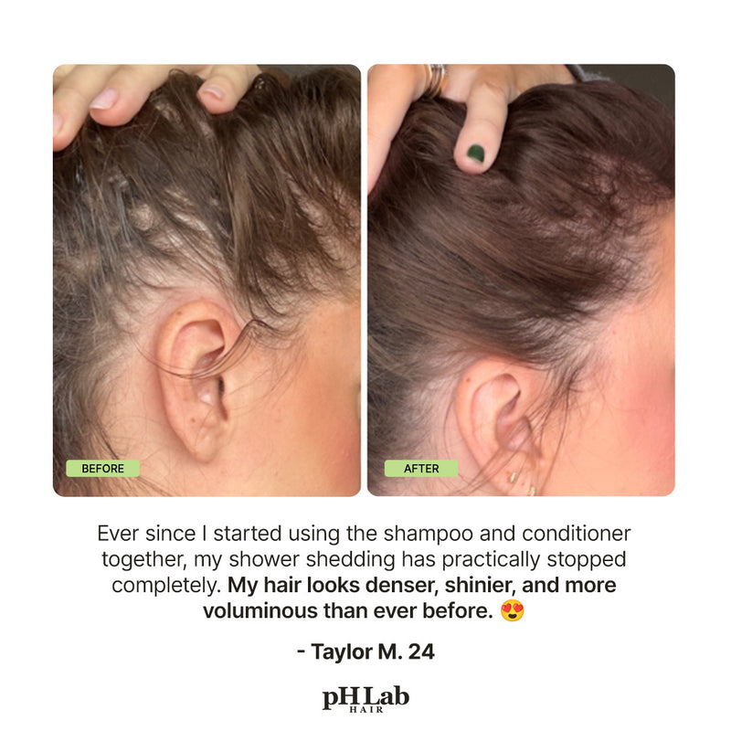 Exosome, NAD+ & Triple PDRN Bonding Repair Set
