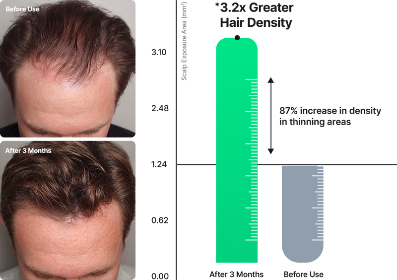 Cellular Thickening
Against Hair Thinning